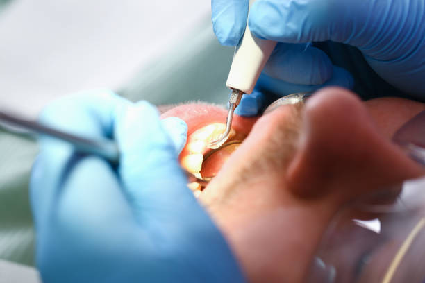 Best Emergency Treatment for Toothache in South Paris, ME