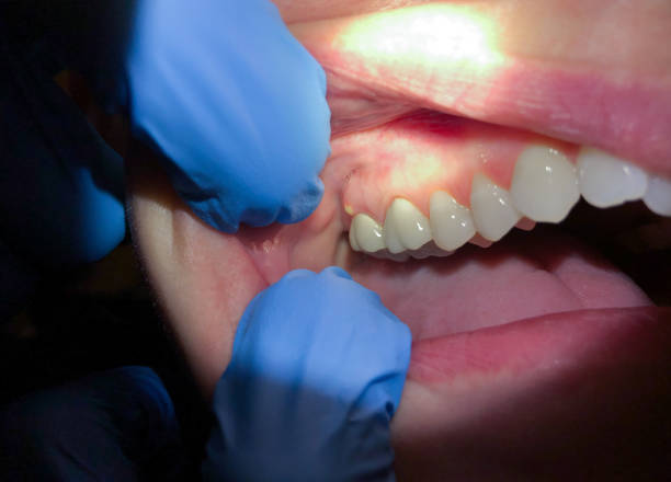 Best Emergency Dental Surgery in South Paris, ME